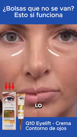 CONTORNO OJOS ANTIBOLSAS WOKALI CON Q10